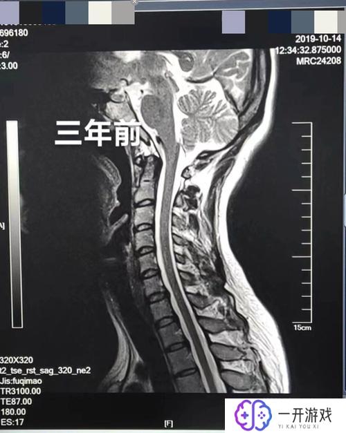 磁共振要做多久,磁共振检查时长揭秘