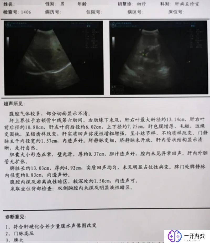 门脉增宽什么意思,门脉增宽症状及原因解析