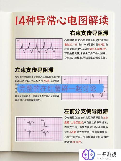 异常是什么意思,异常定义及含义解析