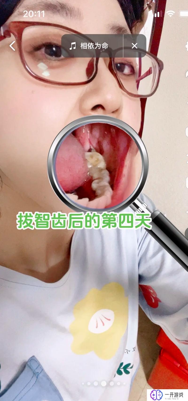 拔智齿什么季节拔比较好一点,春季最适合拔智齿？最佳季节选拔攻略